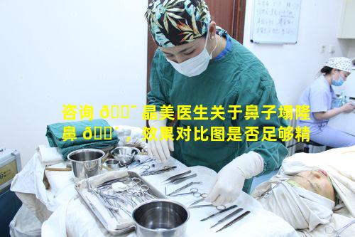 咨询 🐯 晶美医生关于鼻子塌隆鼻 🌴 ，效果对比图是否足够精彩